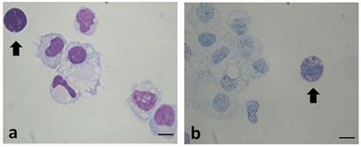 Mast Cells in Peritoneal Fluid From Women With Endometriosis and Their Possible Role in Modulating Sperm Function